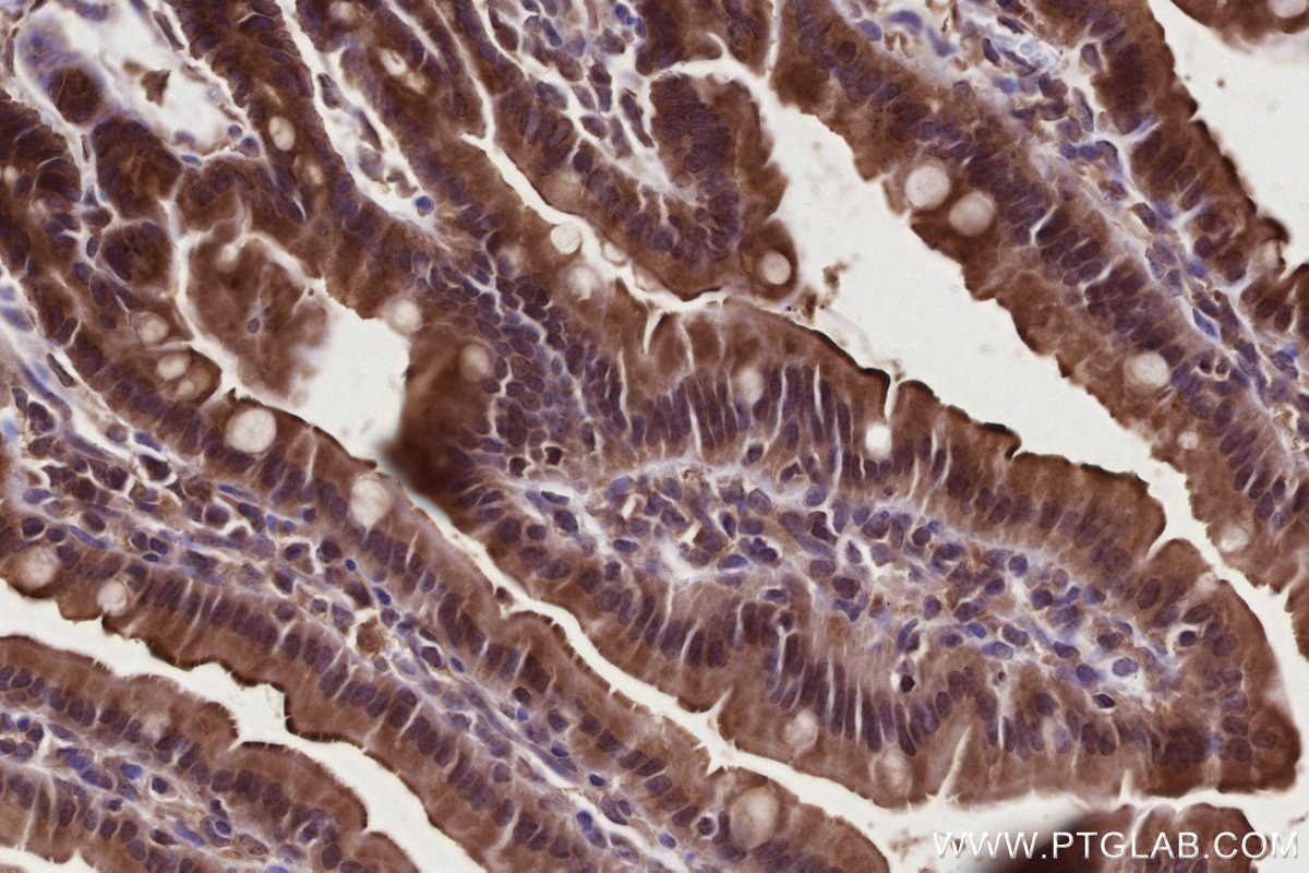 Immunohistochemistry (IHC) staining of mouse small intestine tissue using TBRG4 Polyclonal antibody (10177-2-AP)
