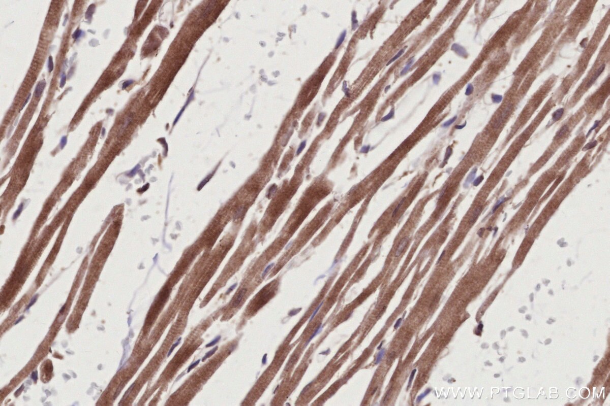 Immunohistochemistry (IHC) staining of rat heart tissue using TBRG4 Polyclonal antibody (10177-2-AP)