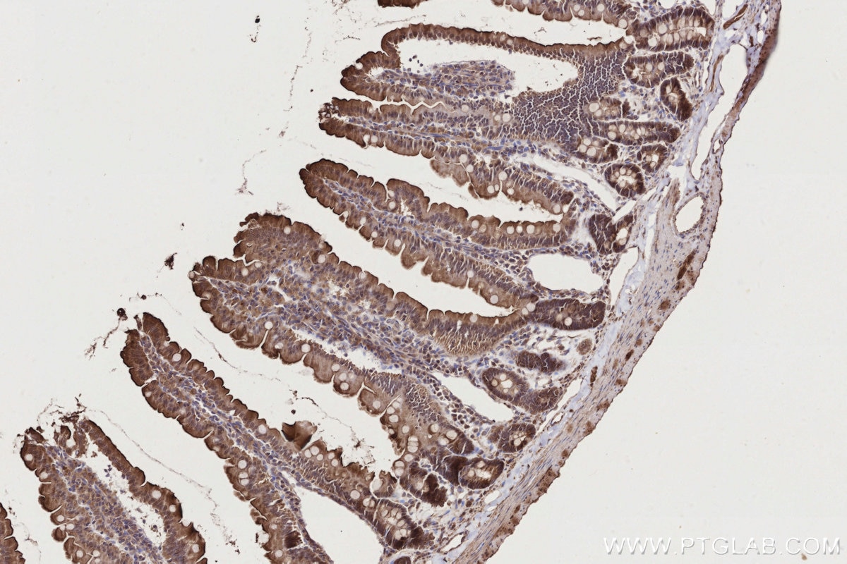 Immunohistochemistry (IHC) staining of rat small intestine tissue using TBRG4 Polyclonal antibody (10177-2-AP)