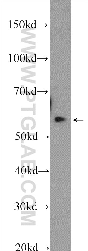 Western Blot (WB) analysis of HepG2 cells using TBRG4 Polyclonal antibody (10177-2-AP)