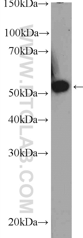 Western Blot (WB) analysis of A431 cells using TBRG4 Polyclonal antibody (10177-2-AP)
