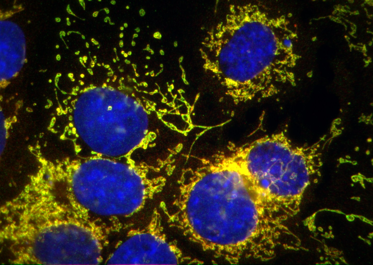 Immunofluorescence (IF) / fluorescent staining of COS7 cells using TBRG4 Polyclonal antibody (16245-1-AP)