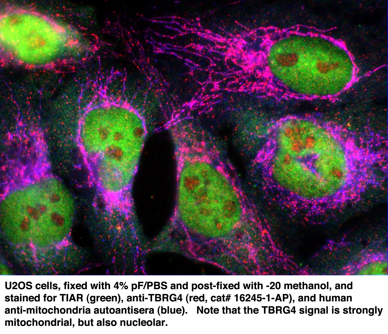 Immunofluorescence (IF) / fluorescent staining of U2OS cells using TBRG4 Polyclonal antibody (16245-1-AP)