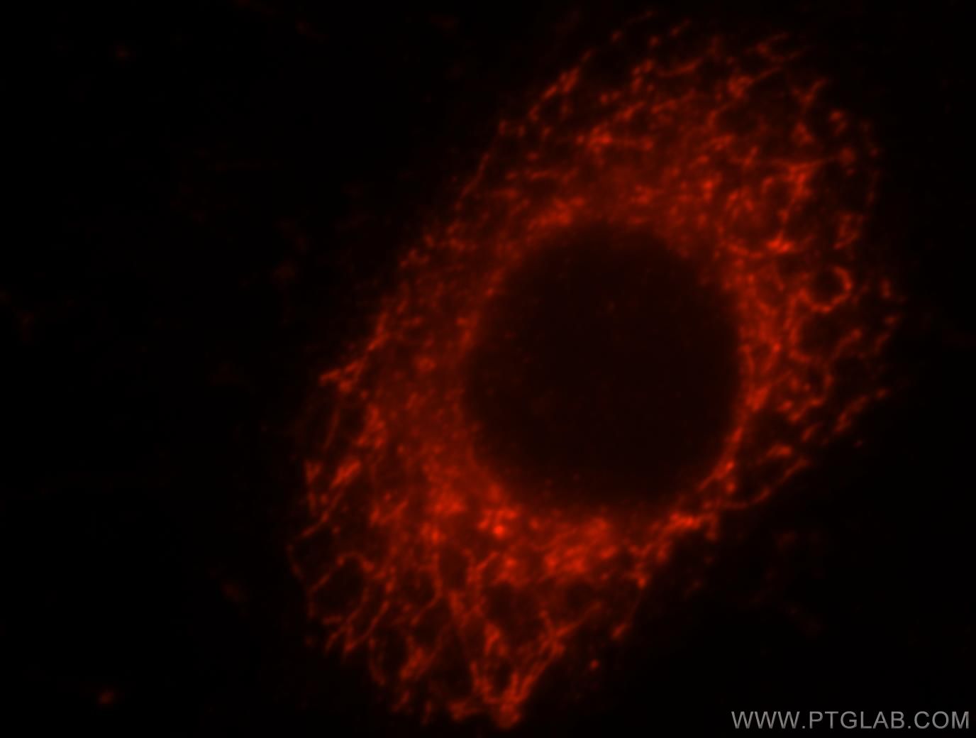 Immunofluorescence (IF) / fluorescent staining of HeLa cells using TBRG4 Polyclonal antibody (16245-1-AP)