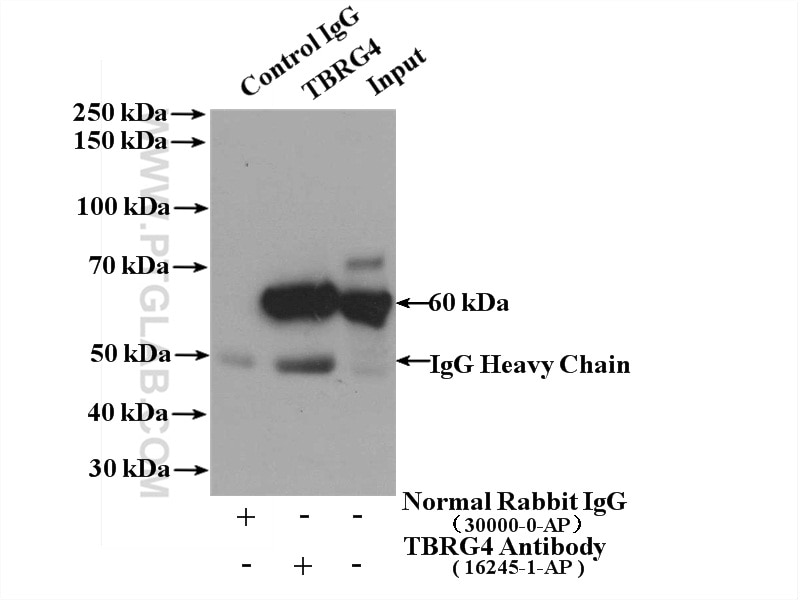Immunoprecipitation (IP) experiment of HepG2 cells using TBRG4 Polyclonal antibody (16245-1-AP)