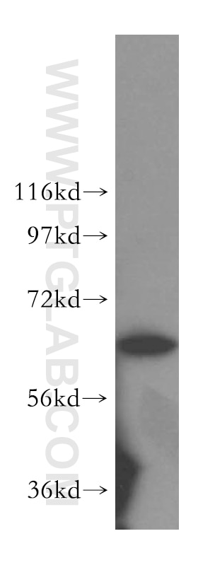 Western Blot (WB) analysis of HeLa cells using TBRG4 Polyclonal antibody (16245-1-AP)