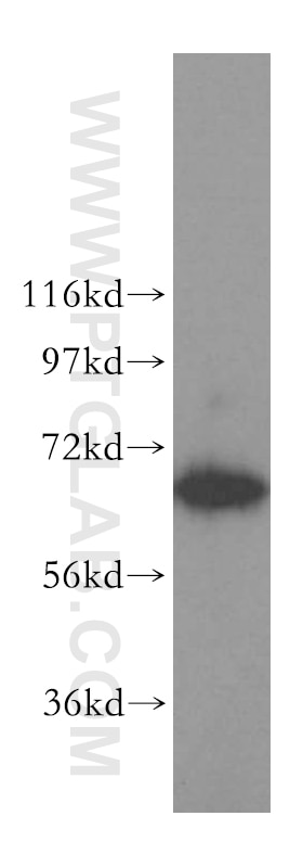 Western Blot (WB) analysis of HepG2 cells using TBRG4 Polyclonal antibody (16245-1-AP)