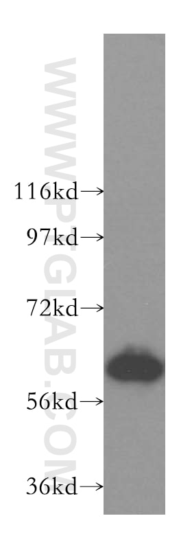 Western Blot (WB) analysis of human liver tissue using TBRG4 Polyclonal antibody (16245-1-AP)