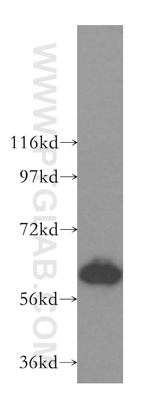 WB analysis of human liver using 16245-1-AP