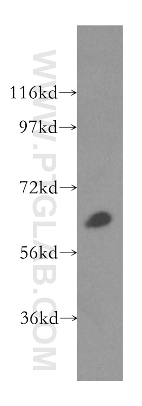 Western Blot (WB) analysis of mouse ovary tissue using TBRG4 Polyclonal antibody (16245-1-AP)