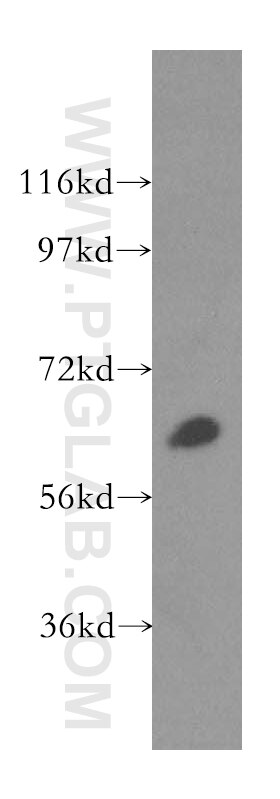 Western Blot (WB) analysis of mouse ovary tissue using TBRG4 Polyclonal antibody (16245-1-AP)