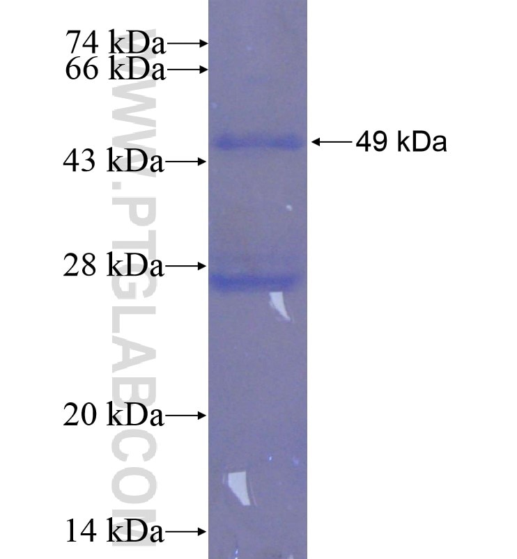 TBRG4 fusion protein Ag0212 SDS-PAGE