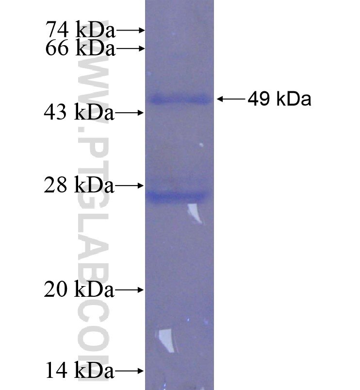 TBRG4 fusion protein Ag0212 SDS-PAGE