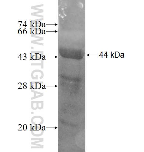 TBRG4 fusion protein Ag9166 SDS-PAGE