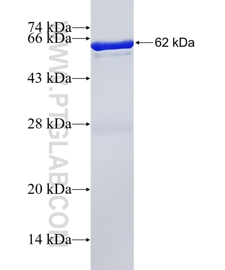 TBRG4 fusion protein Ag9176 SDS-PAGE