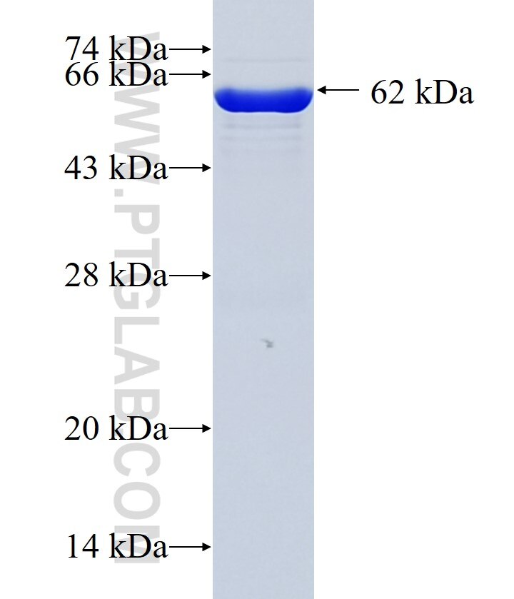 TBRG4 fusion protein Ag9176 SDS-PAGE