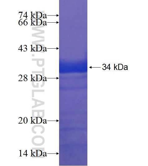 TBX15 fusion protein Ag18423 SDS-PAGE