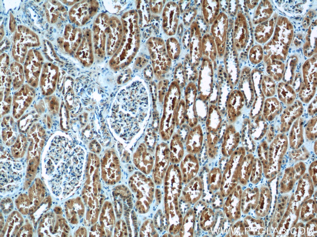 Immunohistochemistry (IHC) staining of human kidney tissue using TBX18 Polyclonal antibody (23237-1-AP)