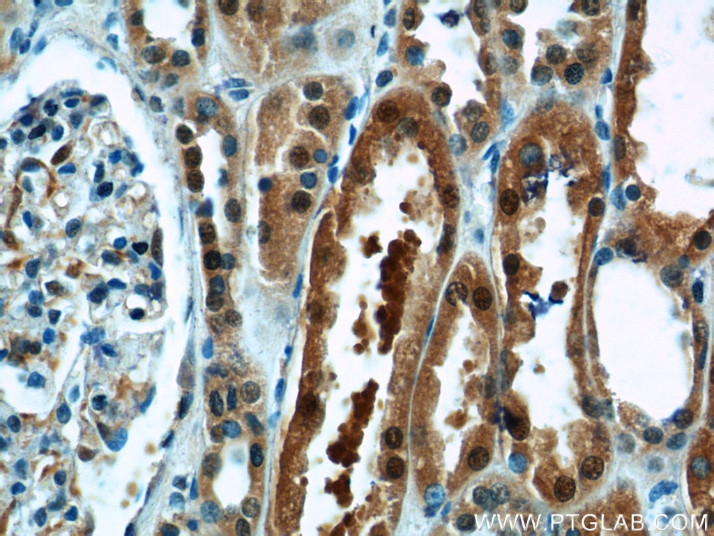 Immunohistochemistry (IHC) staining of human kidney tissue using TBX18 Polyclonal antibody (23237-1-AP)