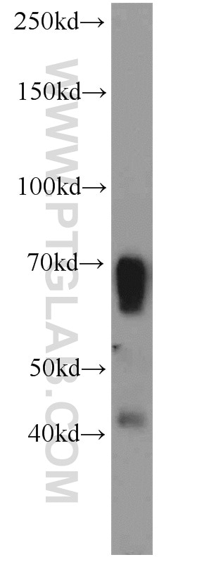 Western Blot (WB) analysis of mouse kidney tissue using TBX18 Polyclonal antibody (23237-1-AP)