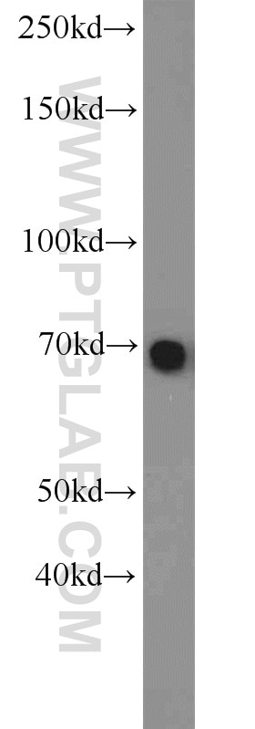 Western Blot (WB) analysis of HeLa cells using TBX18 Polyclonal antibody (23237-1-AP)