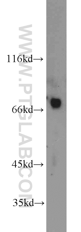Western Blot (WB) analysis of rat kidney tissue using TBX18 Polyclonal antibody (23237-1-AP)