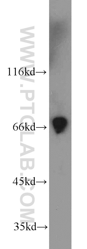Western Blot (WB) analysis of human placenta tissue using TBX18 Polyclonal antibody (23237-1-AP)