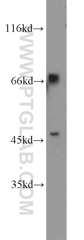 Western Blot (WB) analysis of HEK-293 cells using TBX18 Polyclonal antibody (23237-1-AP)