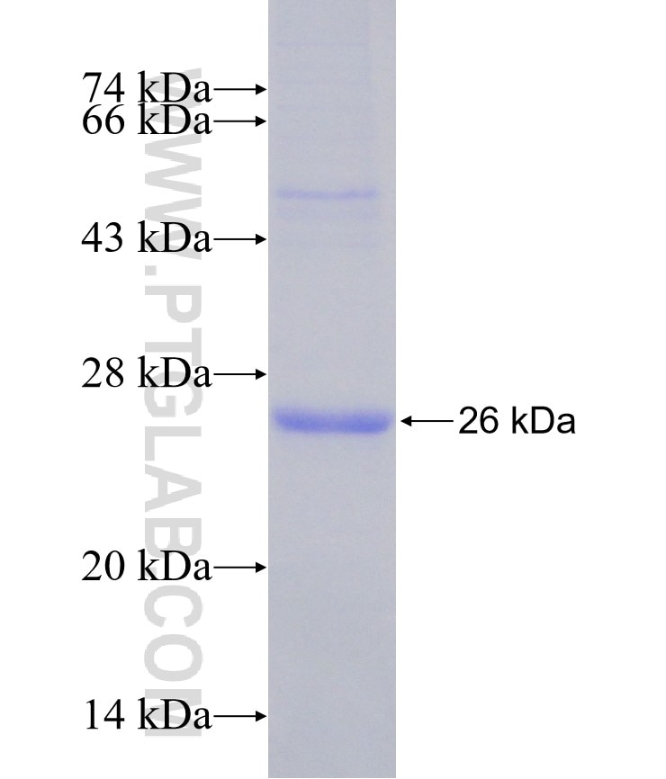 TBX18 fusion protein Ag19258 SDS-PAGE