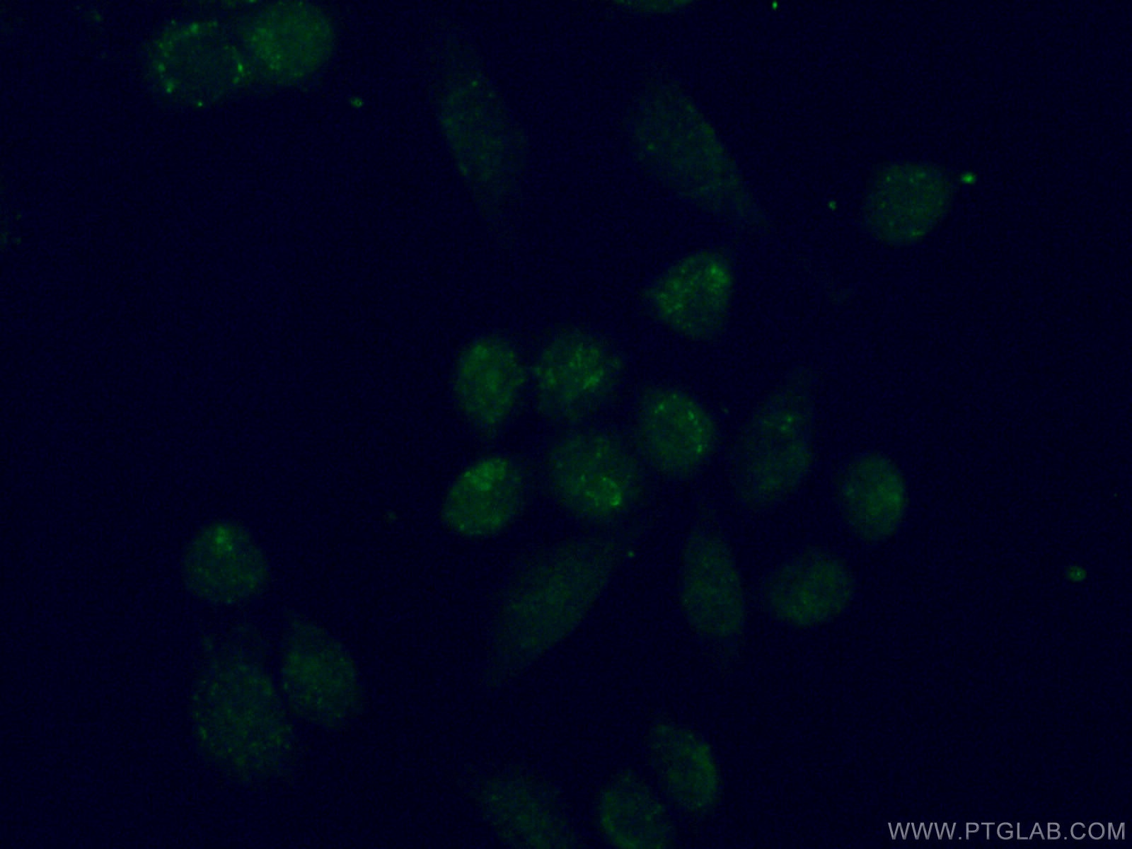 Immunofluorescence (IF) / fluorescent staining of HeLa cells using TBX2 Polyclonal antibody (16930-1-AP)