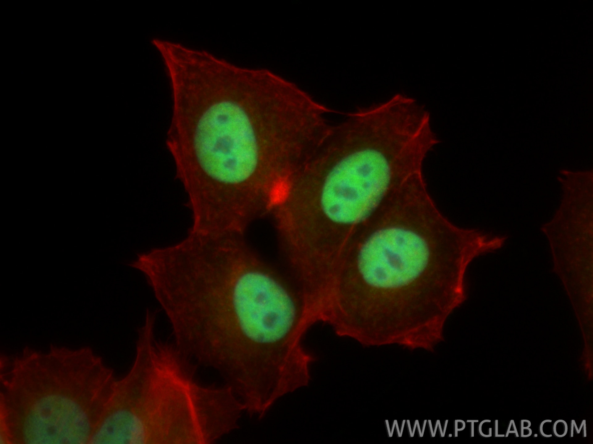 Immunofluorescence (IF) / fluorescent staining of MCF-7 cells using TBX2 Polyclonal antibody (16930-1-AP)