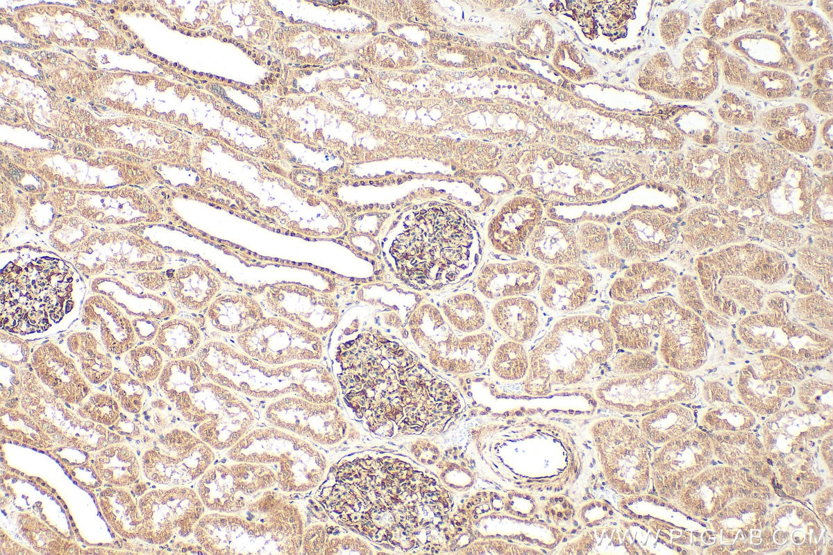 Immunohistochemistry (IHC) staining of human kidney tissue using TBX2 Polyclonal antibody (16930-1-AP)