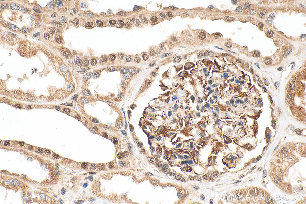 Immunohistochemistry (IHC) staining of human kidney tissue using TBX2 Polyclonal antibody (16930-1-AP)
