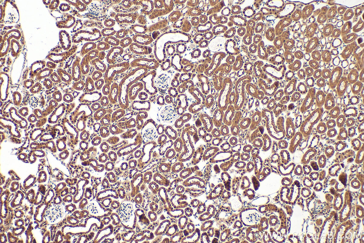 Immunohistochemistry (IHC) staining of mouse kidney tissue using TBX2 Polyclonal antibody (16930-1-AP)