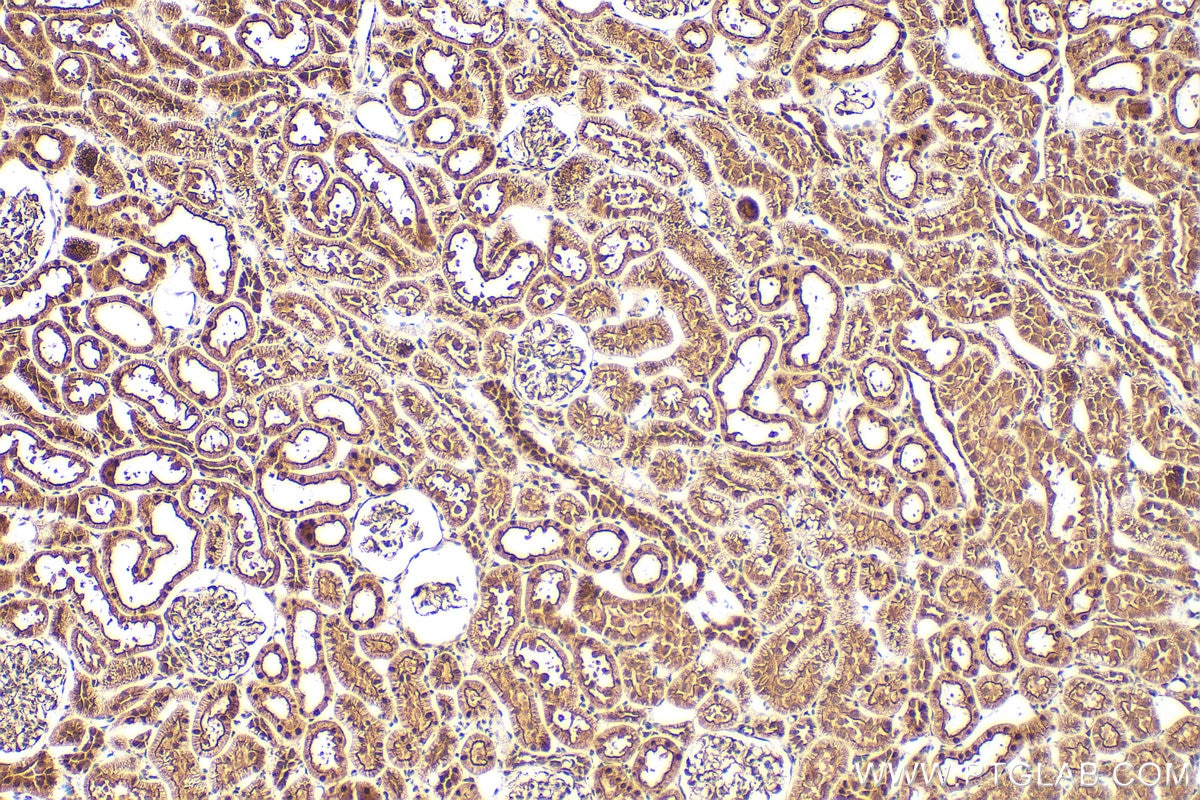 Immunohistochemistry (IHC) staining of rat kidney tissue using TBX2 Polyclonal antibody (16930-1-AP)