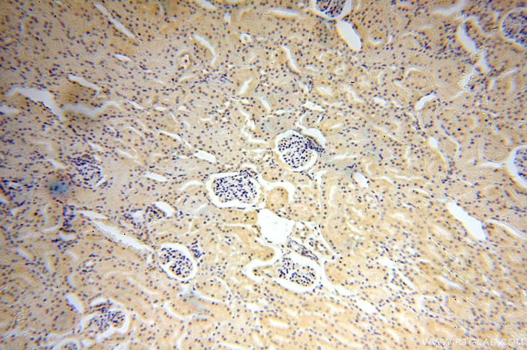 Immunohistochemistry (IHC) staining of human kidney tissue using TBX2 Polyclonal antibody (16930-1-AP)