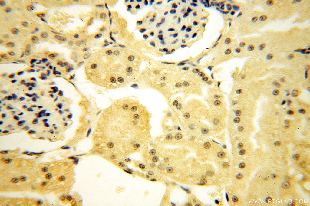 Immunohistochemistry (IHC) staining of human kidney tissue using TBX2 Polyclonal antibody (16930-1-AP)