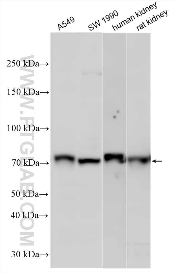 Western Blot (WB) analysis of various lysates using TBX2 Polyclonal antibody (16930-1-AP)