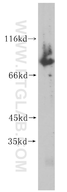 Western Blot (WB) analysis of BxPC-3 cells using TBX2 Polyclonal antibody (16930-1-AP)