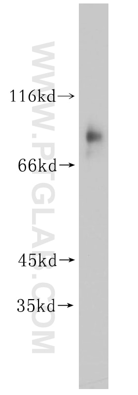 Western Blot (WB) analysis of human placenta tissue using TBX2 Polyclonal antibody (16930-1-AP)