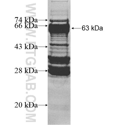 TBX2 fusion protein Ag10393 SDS-PAGE