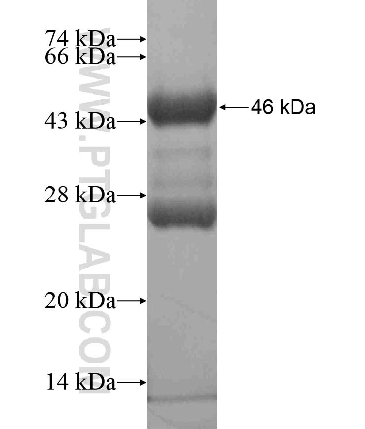 TBX20 fusion protein Ag18495 SDS-PAGE