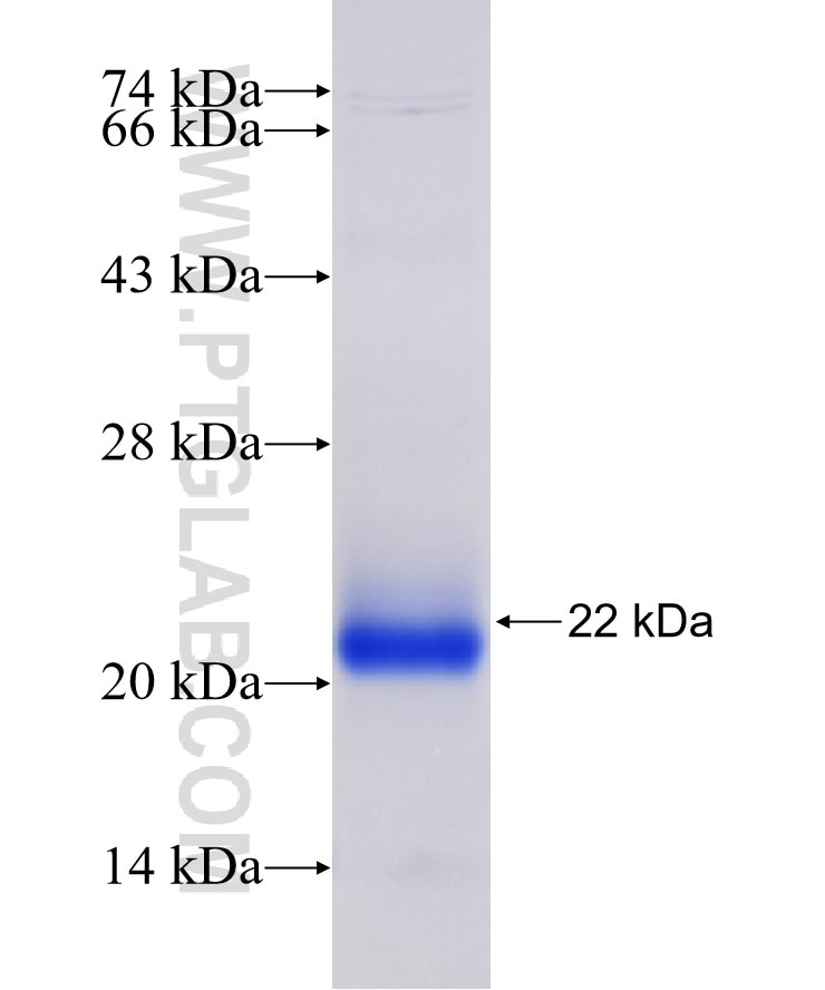 TBX20 fusion protein Ag18501 SDS-PAGE