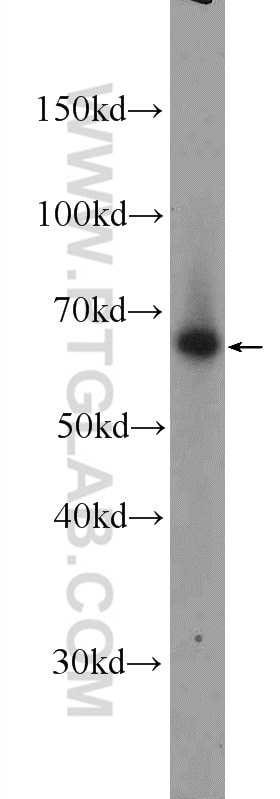 Western Blot (WB) analysis of mouse thymus tissue using TBX21,T-bet Polyclonal antibody (13700-1-AP)