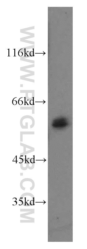 TBX21,T-bet Polyclonal antibody