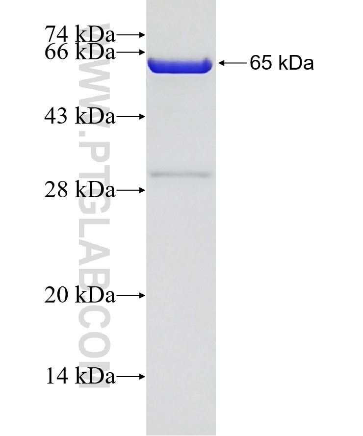 TBX21,T-bet fusion protein Ag4618 SDS-PAGE