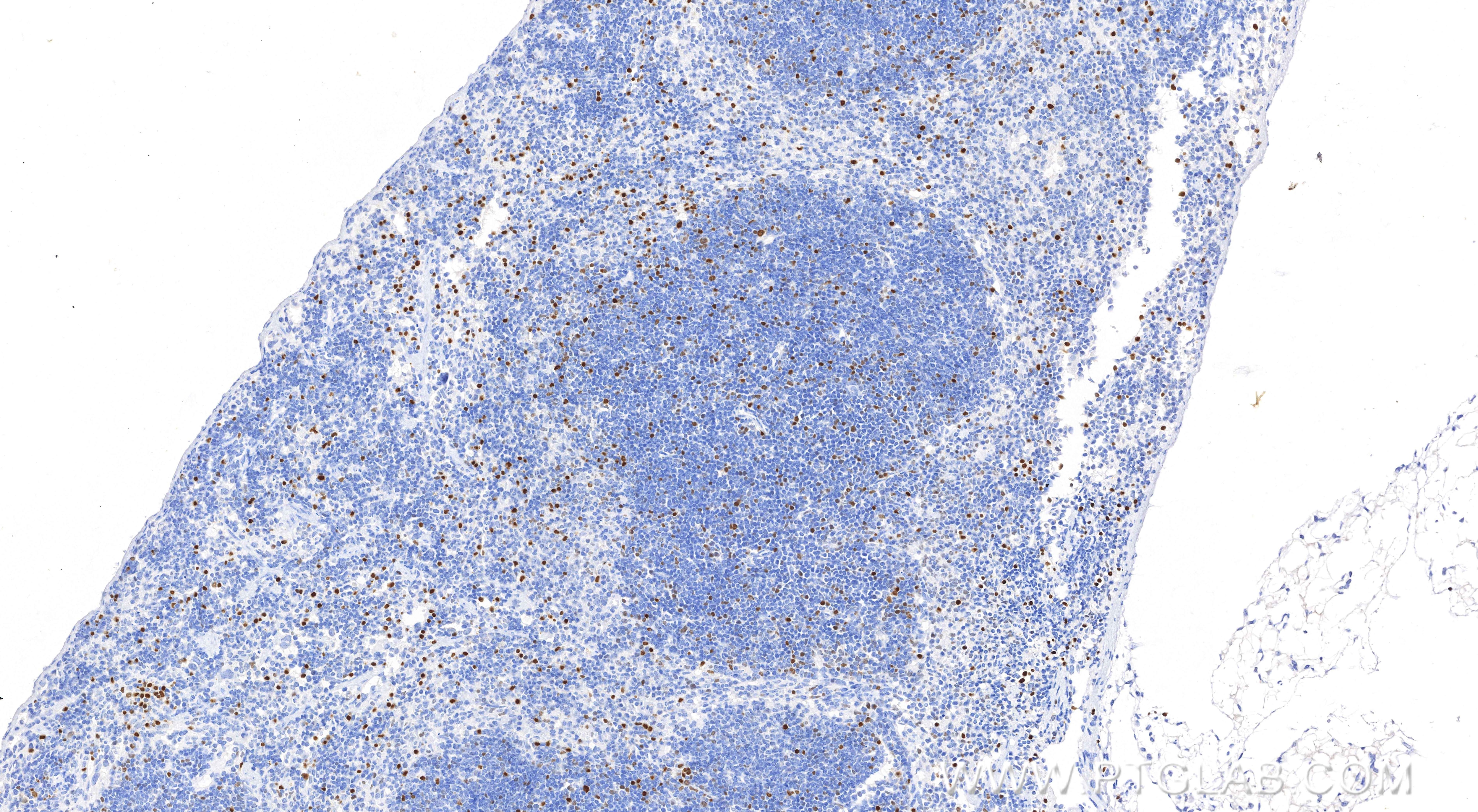 Immunohistochemistry (IHC) staining of mouse spleen tissue using TBX21/T-bet Recombinant monoclonal antibody (83804-6-RR)