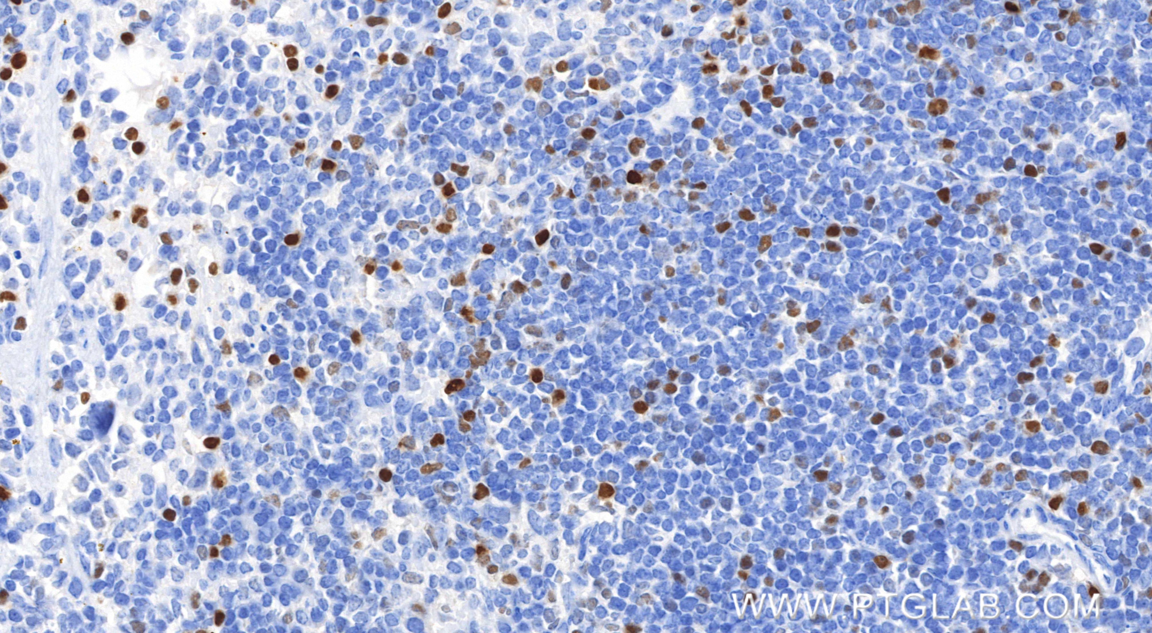 Immunohistochemistry (IHC) staining of mouse spleen tissue using TBX21/T-bet Recombinant monoclonal antibody (83804-6-RR)