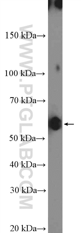 Western Blot (WB) analysis of mouse testis tissue using TBX22 Polyclonal antibody (11133-1-AP)
