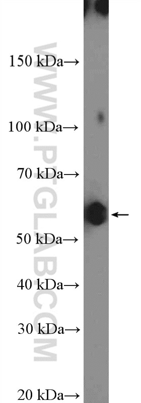 WB analysis of mouse testis using 11133-1-AP